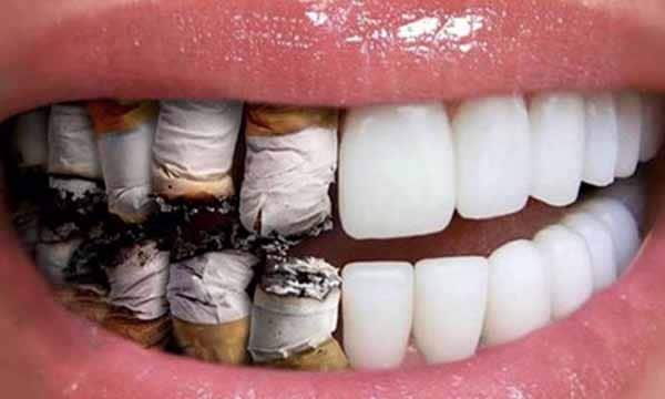 عادات تضر صحة الاسنان