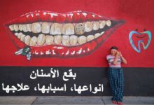 بقع الاسنان