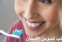 تجنب تسوس الاسنان