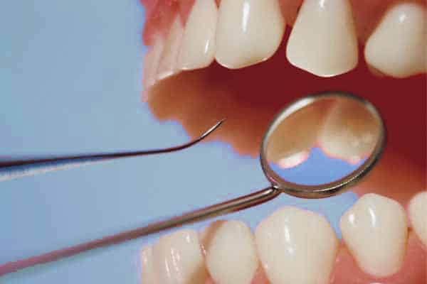 ادوات طبيب الاسنان