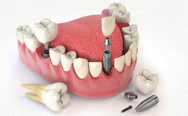 تخصصات طب الأسنان