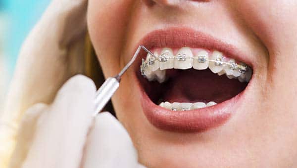 تخصصات طب تقويم الاسنان