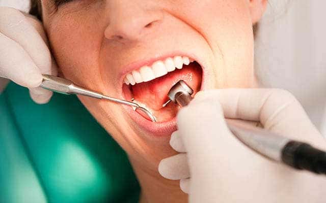  علاج جذور الاسنان