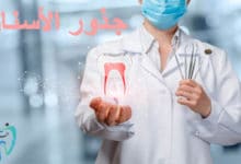 علاج جذور الاسنان