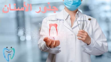 علاج جذور الاسنان