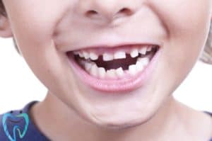 الأسنان اللبنية للاطفال