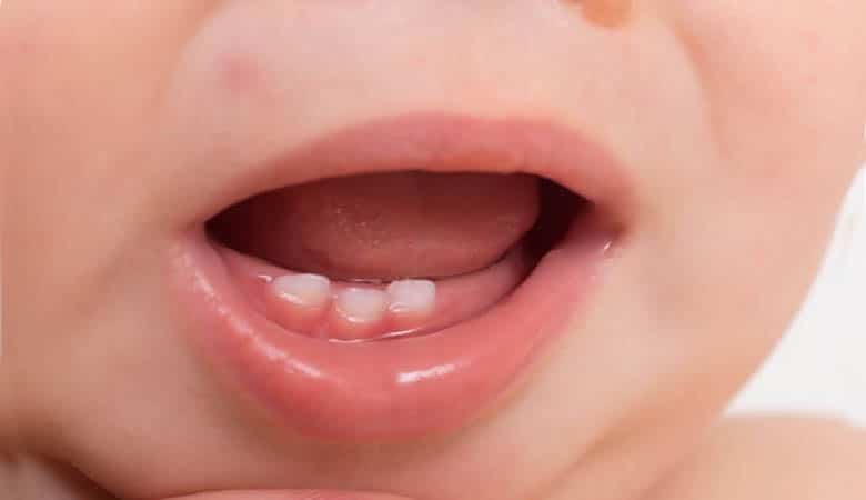 تأثير الاسنان اللبنية 