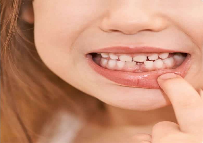 effect of milk teeth