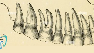 Increasing the number of teeth