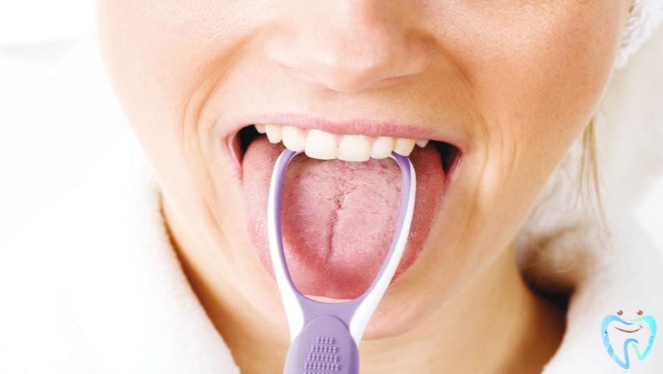 اللسان الجغرافي: أسبابه - تشخيصه - علاجه وطرق الوقاية منه